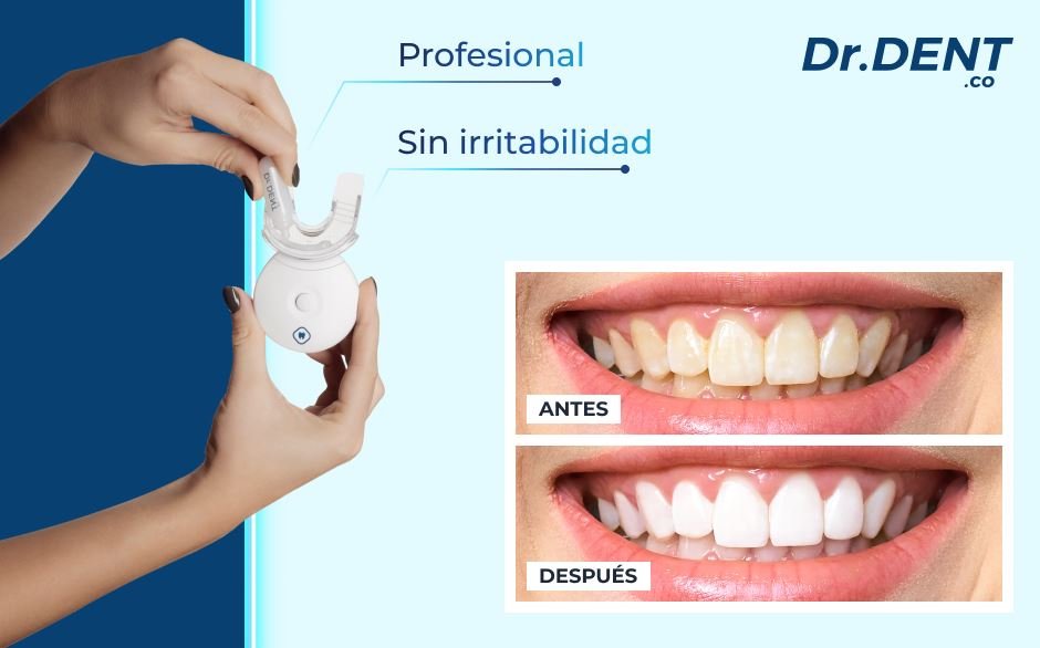 kit blanqueamiento dr dent opiniones