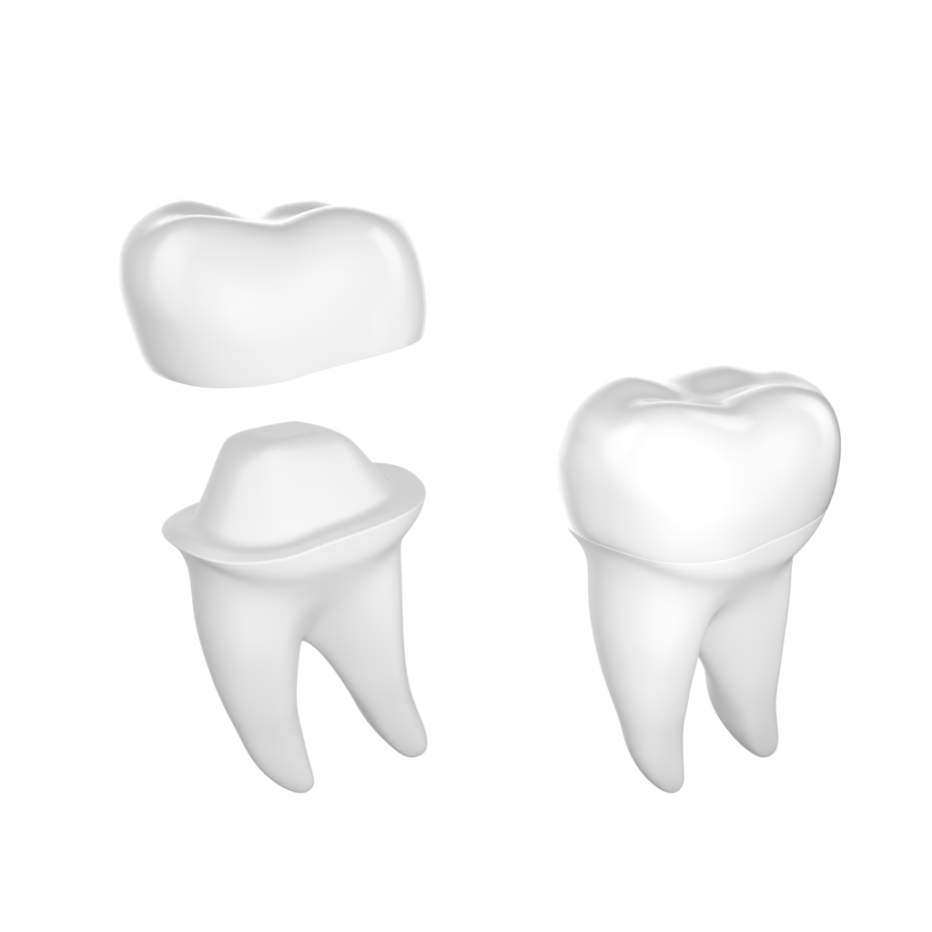 Corona dental de porcelana