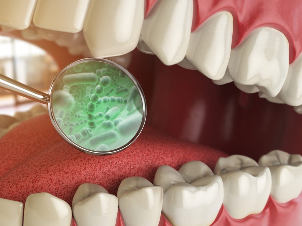 Bacterias and viruses around tooth