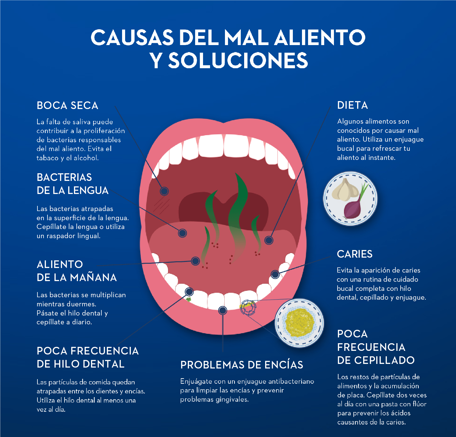 Causas Del Mal Aliento ¡descubre Como Eliminarlo 4928