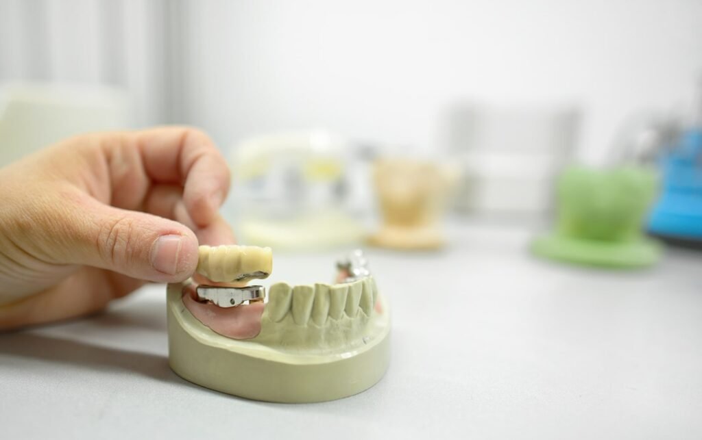 Implantes dentales 3 en 6 (pros, contras y costos)