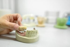 Implantes dentales 3 en 6 (pros, contras y costos)