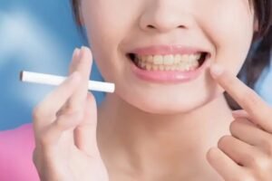 El efecto de fumar en los dientes, encías y salud oral