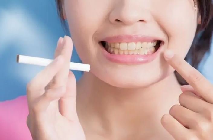 como afecta el fumar en los dientes