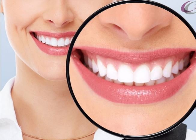 Blanqueamiento Dental Casero más Efectivo