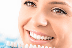 Clareamento dental em Torrente