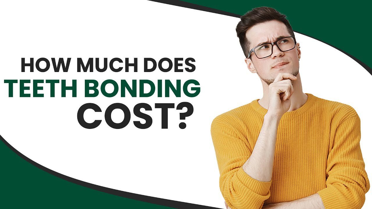 The Cost of Dental Bonding A Comprehensive Guide